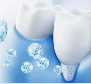 nHAP EnamelShield+ Enamel Repair Toothpaste 6 nHAP EnamelShield+ enamel repair toothpaste